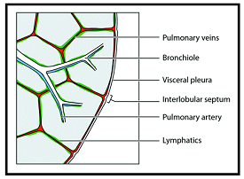 1206_Pulmonary Edema1.png